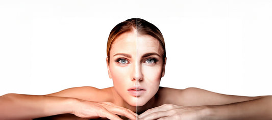 Exosomas: La Revolución en el Rejuvenecimiento Facial en CB Clínica Estética - Cara Bonita Medicina Estetica