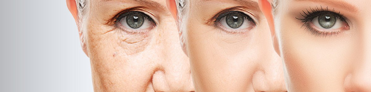 Rejuvenecimiento facial no invasivo con HIFU: Descubre la revolución próximamente en CB Clínica Estética
