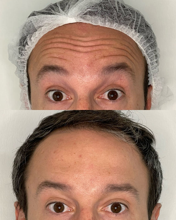 Caso real CB Clínica Estética — Instagram