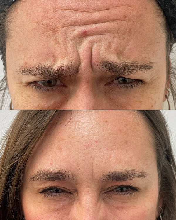 Caso real CB Clínica Estética — Instagram