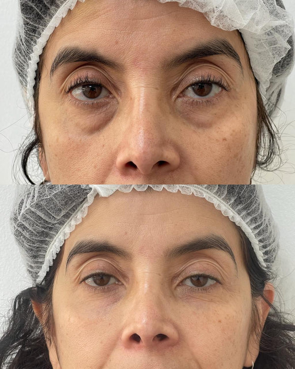 Caso real CB Clínica Estética — Instagram