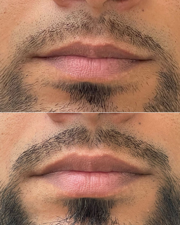 Caso real CB Clínica Estética — Instagram
